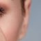 DIABETIC EYE DISEASE